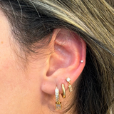 Auricle Mid-helix